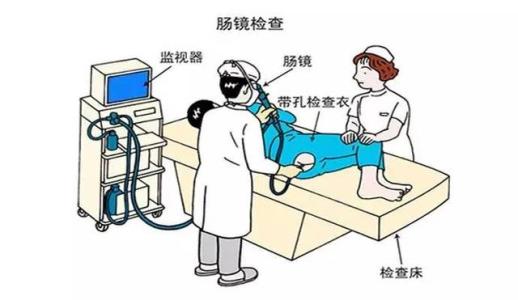 肛門狹窄，治療